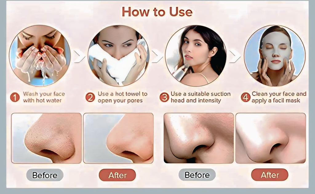 Portable Blackhead Remover™ | Deep Clean, Smooth Skin(COD Available)