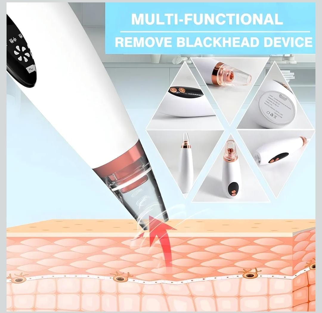 Portable Blackhead Remover™ | Deep Clean, Smooth Skin(COD Available)