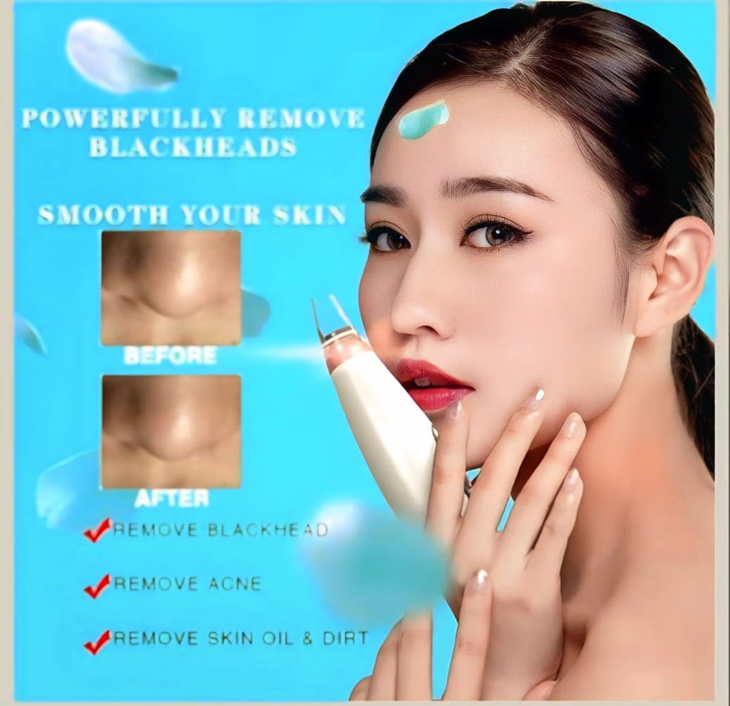 Portable Blackhead Remover™ | Deep Clean, Smooth Skin(COD Available)